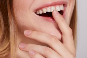 manchas blancas dientes