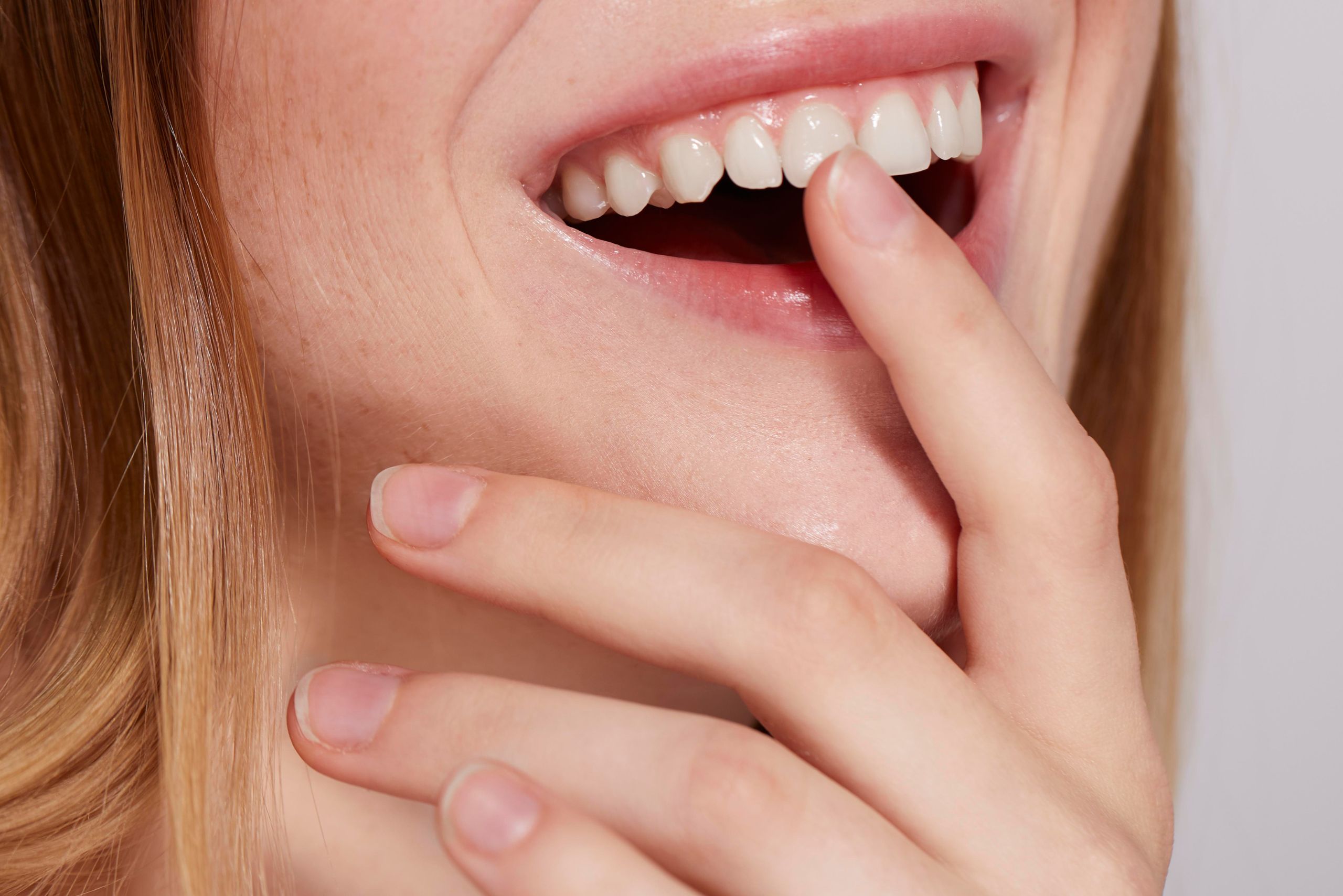 manchas blancas dientes