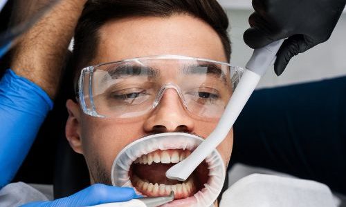 limpieza-dental